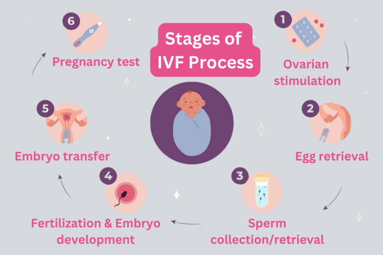 Stage of IVF